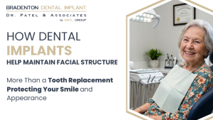 How Dental Implants Help Maintain Facial Structure