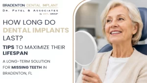 How Long Do Dental Implants Last?